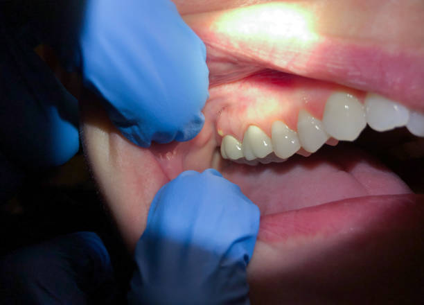 Best Emergency Broken Tooth Repair in Harker Heights, TX